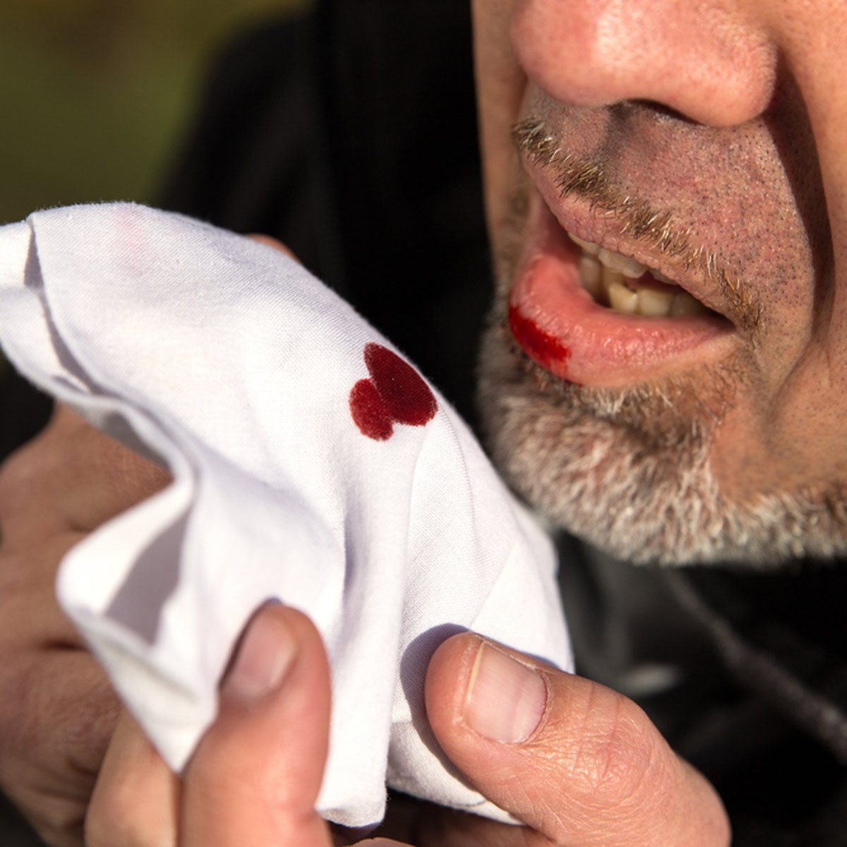 Blood Stain Cleaner