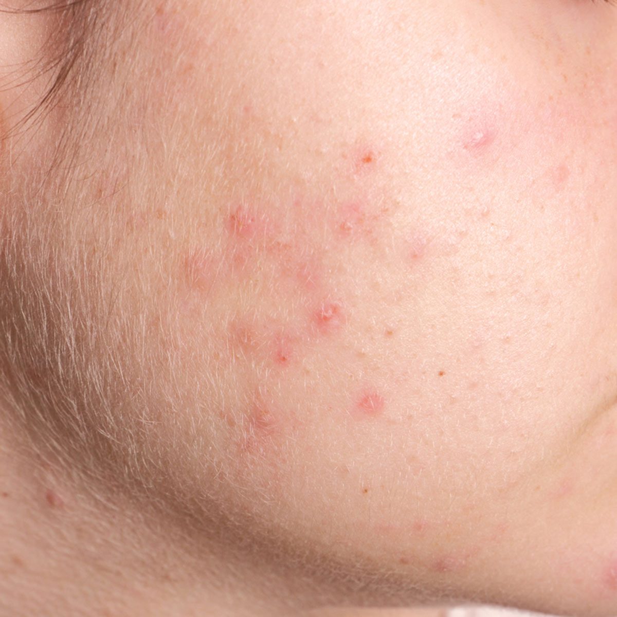 Skin Cream