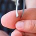 5 Home Remedies to Remove a Splinter