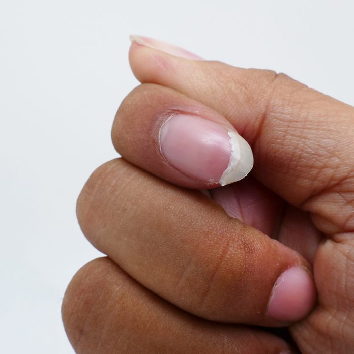 nail