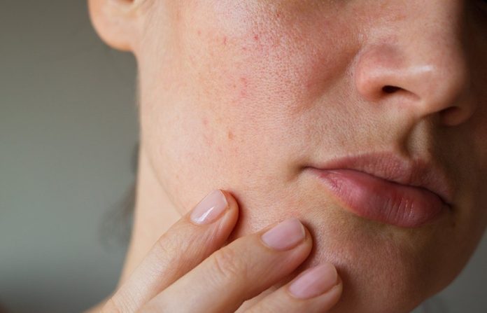 pores on the skin of the face. Cleansing the face skin