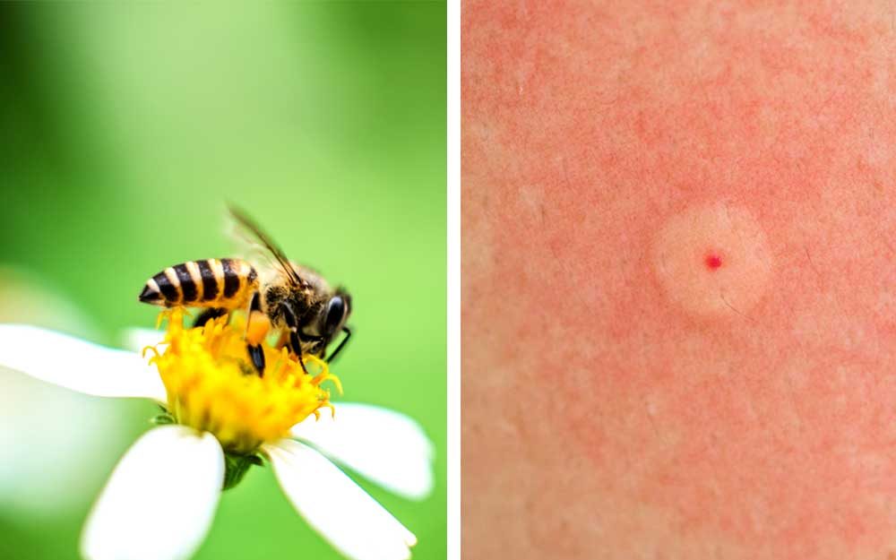 bee
