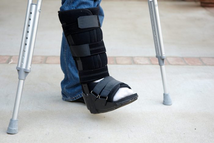 Mature man on crutches