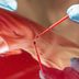 The Best Way to Repair Nicks and Scratches in Your Car's Paint